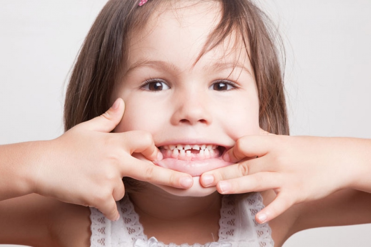 Çocuklarda Çapraşık Diş Tedavisi Nasıl Yapılır?